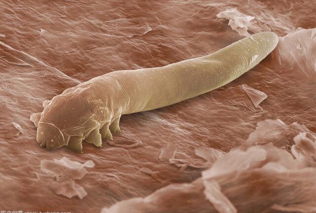 皮脂腺螨蟲圖片